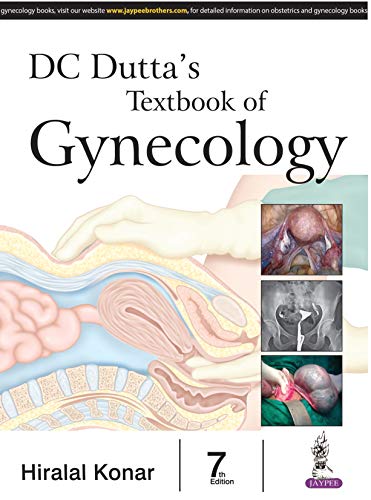 DC Dutta’s Textbook of Gynecology including Contraception